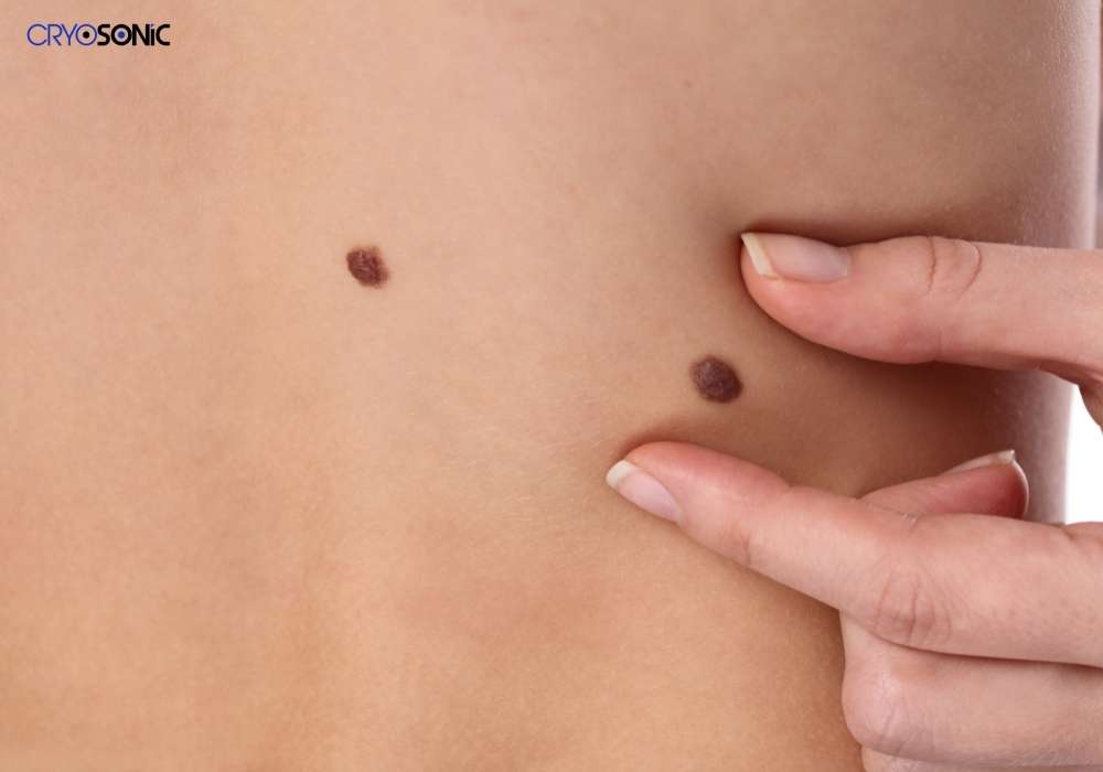 Infection Risk and Poor Aftercare Colchester