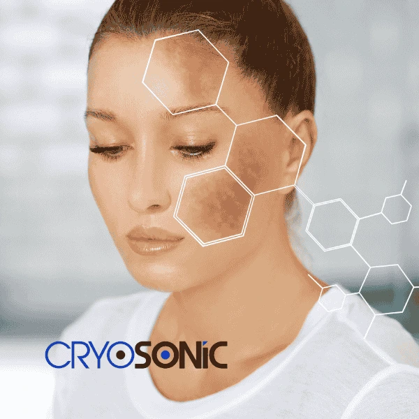 Are you looking for age spot removal treatment? Contact Cryosonic today in Colchester