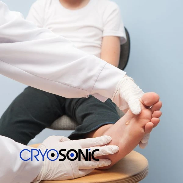 Are you looking for fast effective wart removal Contact us today Colchester